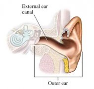 “小物件，大麻烦”，外耳道异物究竟该怎么处理？