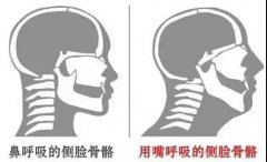 【科普】【专家答疑】切除腺样体、扁桃体会影响孩子的免疫力吗？