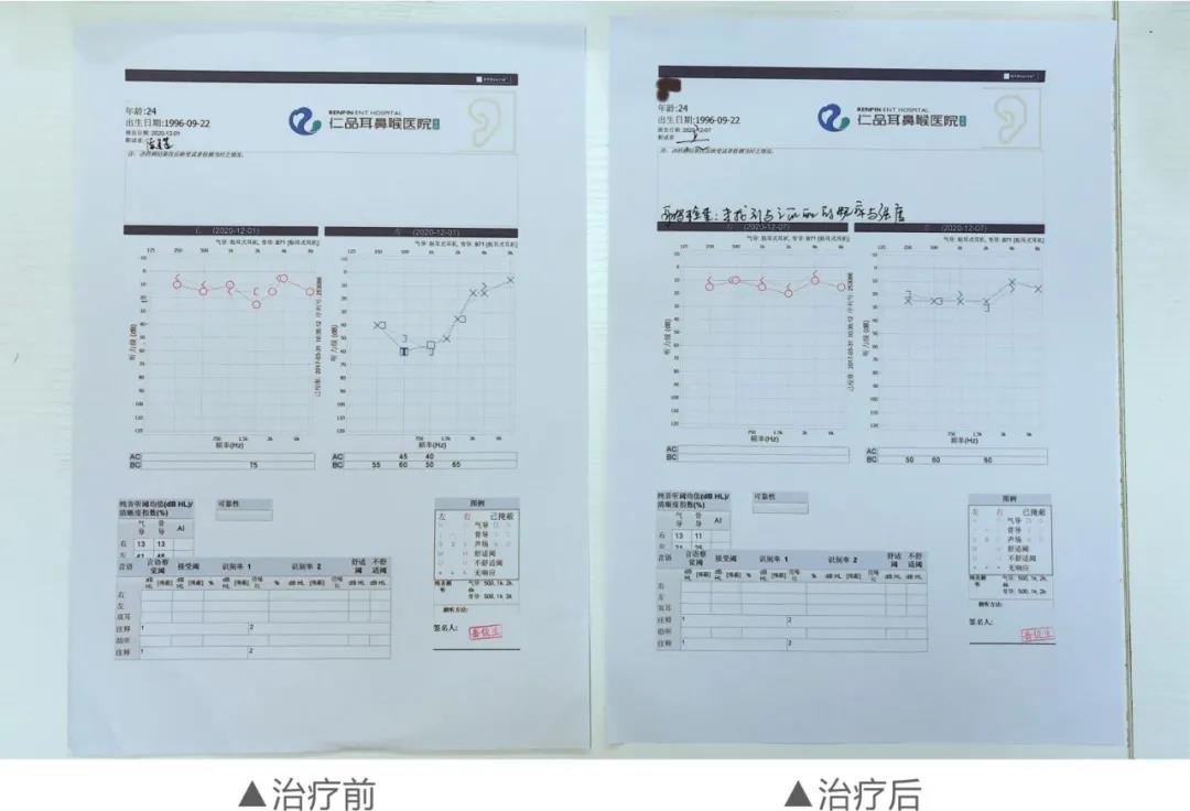 重庆耳鼻喉科医院哪家好